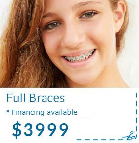 Offer full braces