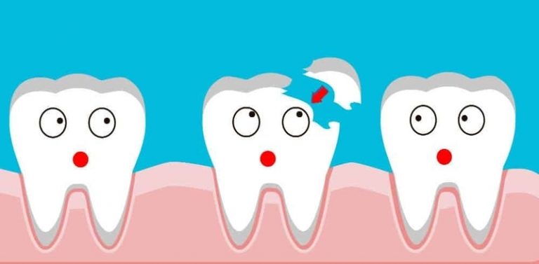 What Happens If I Leave A Broken Tooth Untreated My Dentist Toluca Lake
