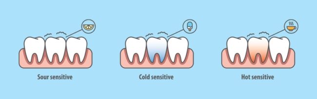 tooth sensetivity