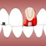 dental problems