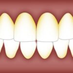 dental problems
