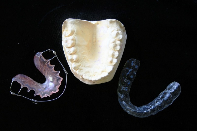 Traditional Dental Braces vs Invisalign Aligners