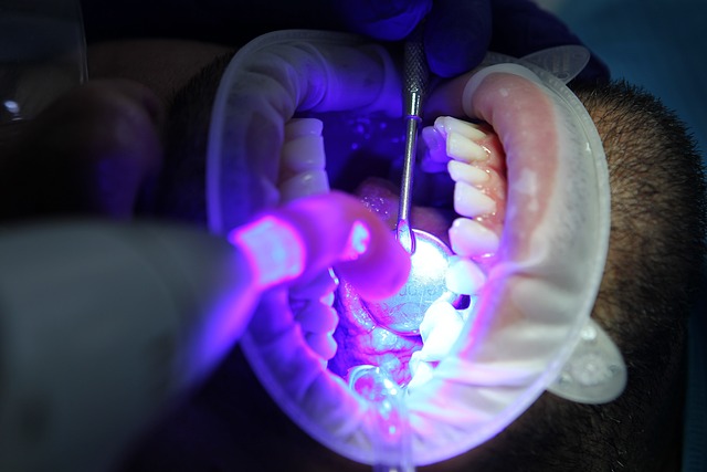 All You Need to Know About Temporary Tooth Fillings